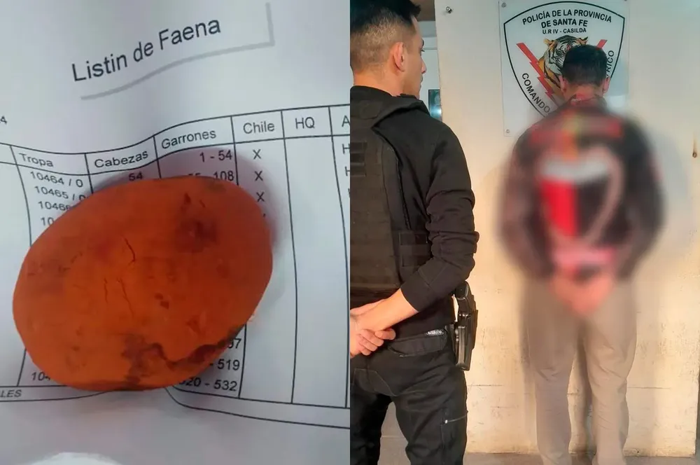 calculos_billiares_detenido_casilda