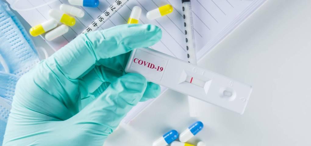 Asi-funcionan-los-test-rapidos-para-la-COVID-19
