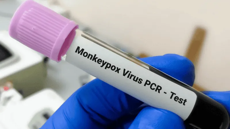 viruela_del_mono_rosario.png_1756841869